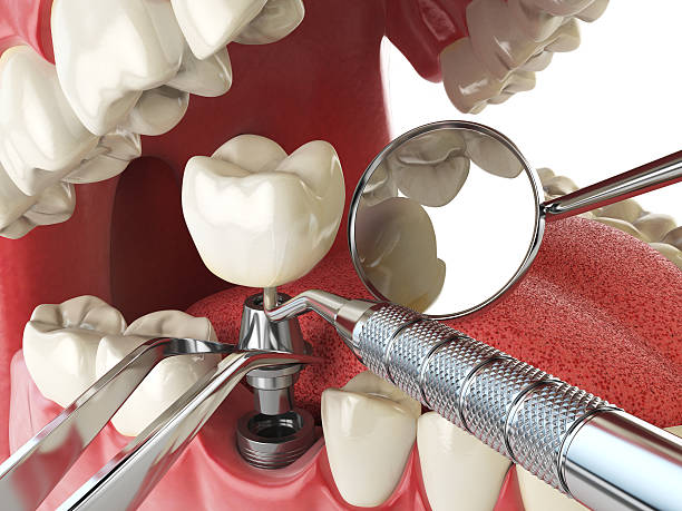 Best Emergency Root Canal Therapy in Dock Junction, GA